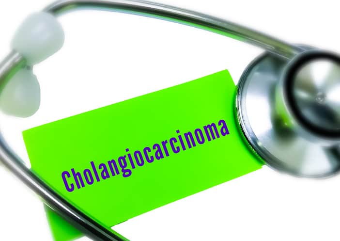 Le cholangiocarcinome dans la vie réelle