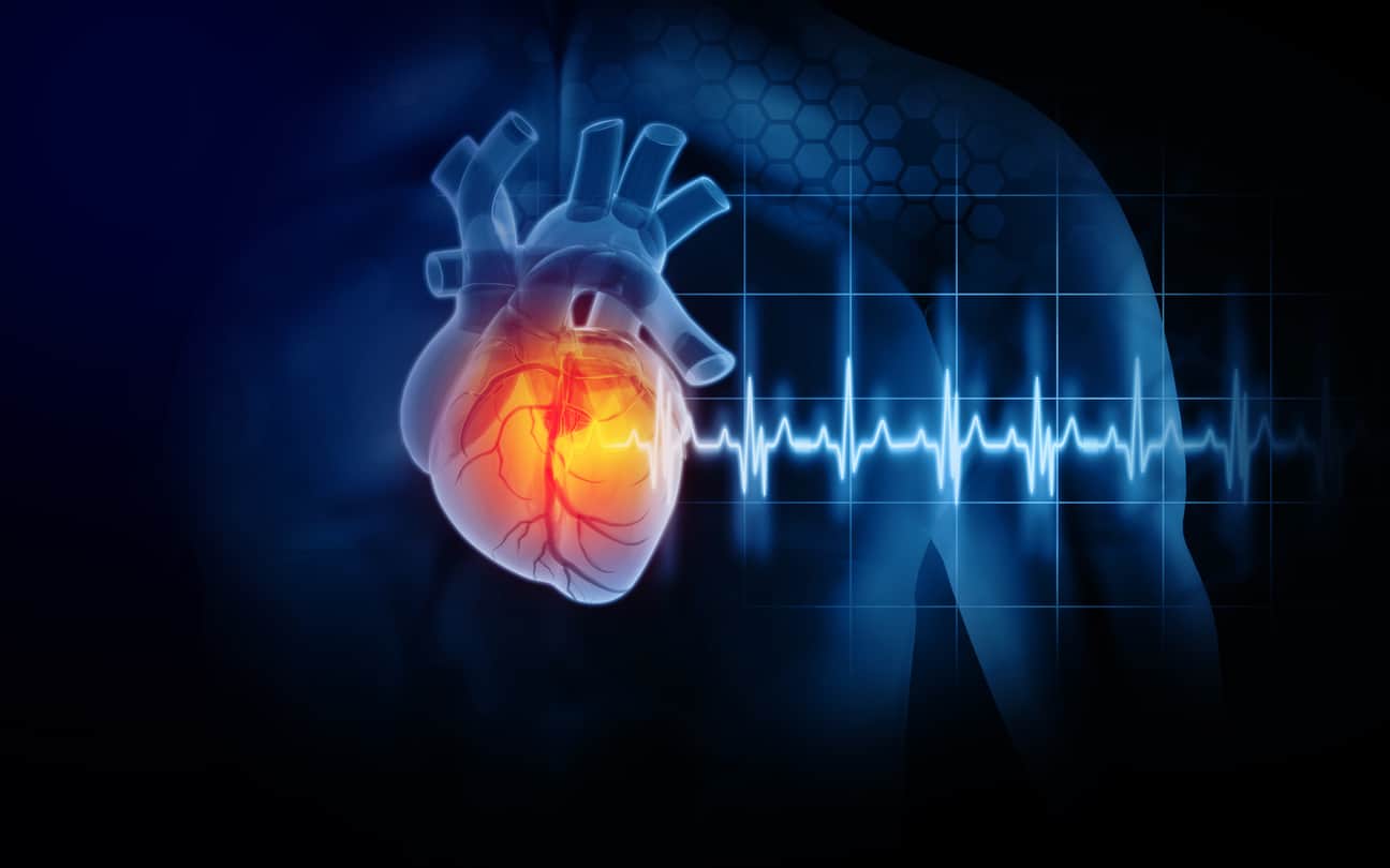 Le fer dans l’insuffisance cardiaque