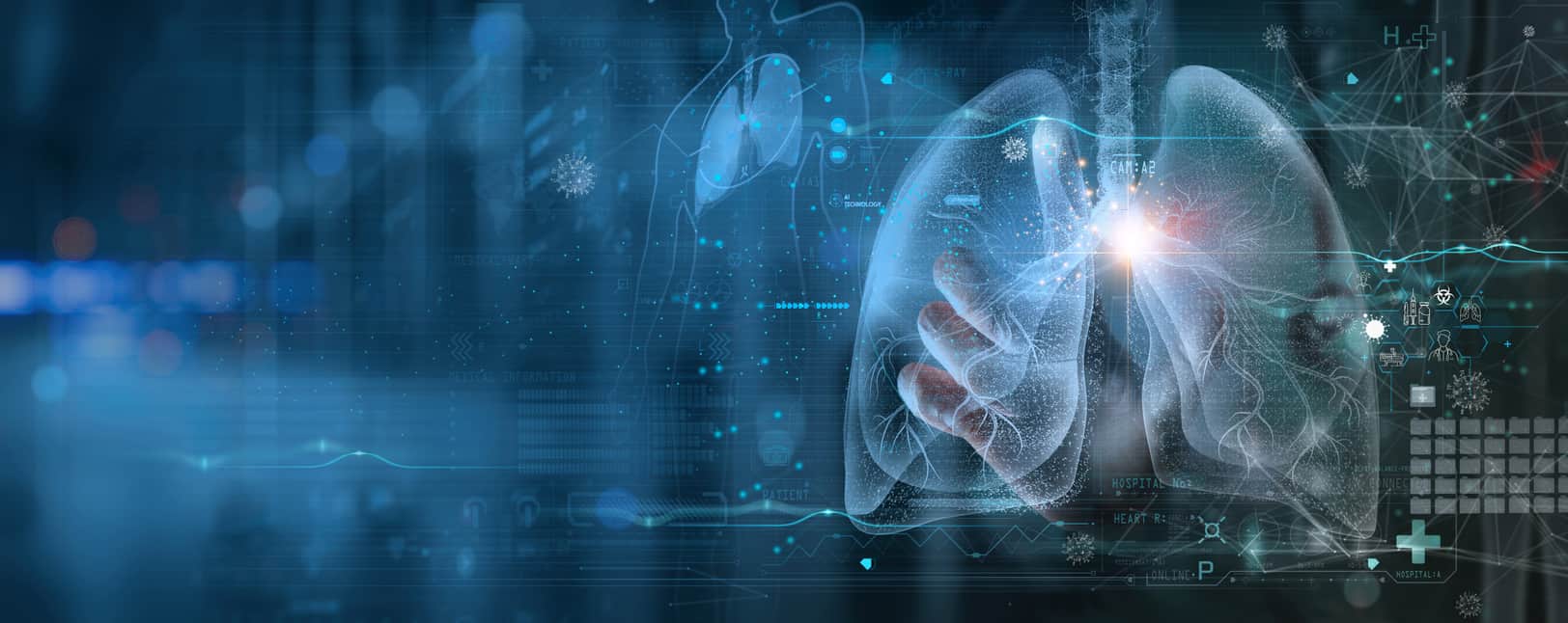 Les grands modèles de langage en radiologie