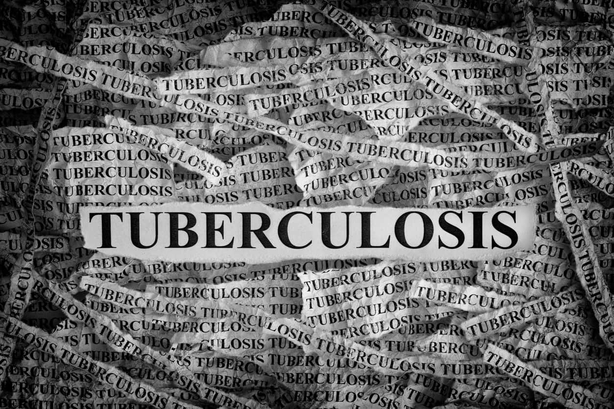 MDR-TB : 9 mois pour tout changer ?