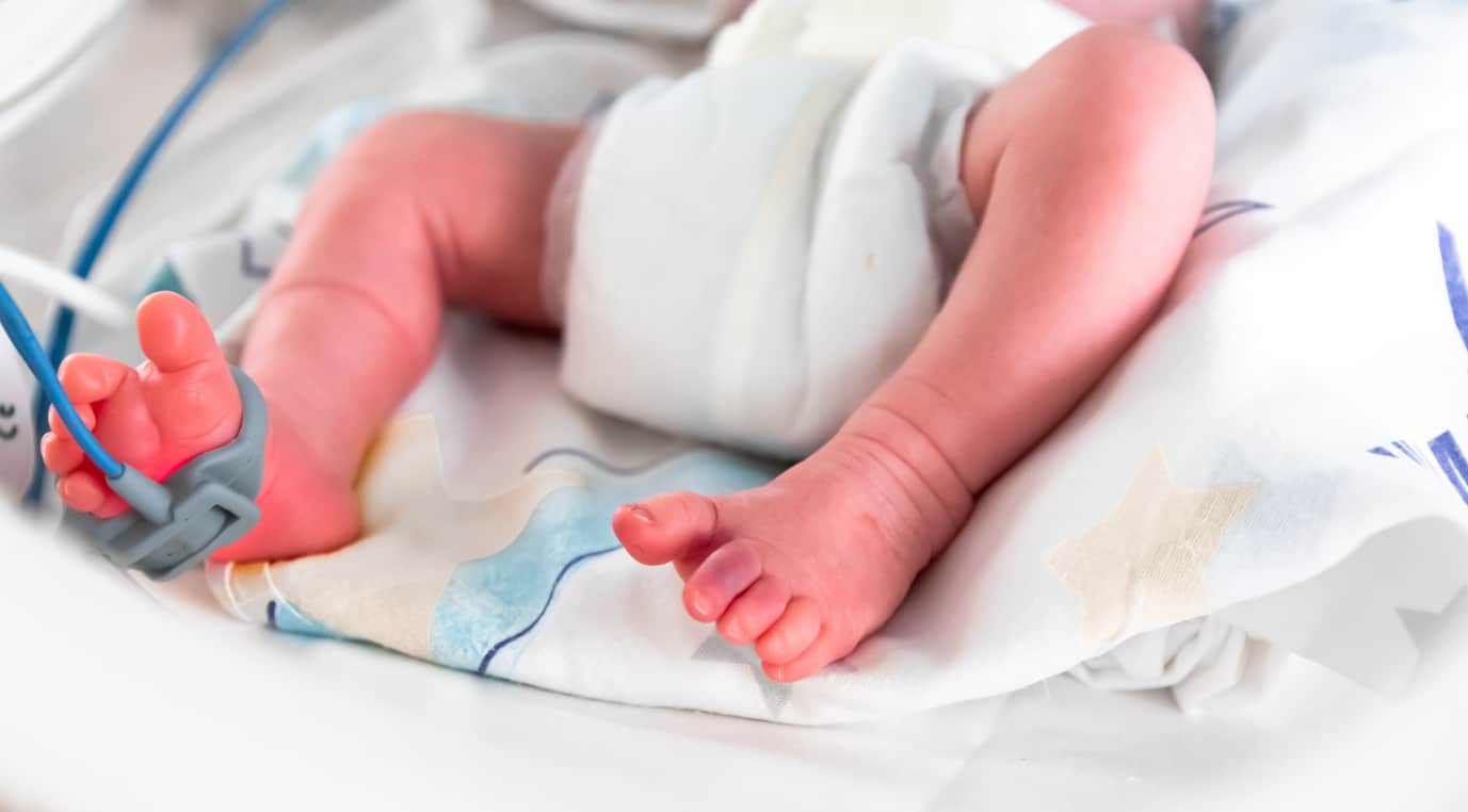 Taille de la sonde endotrachéale néonatale
