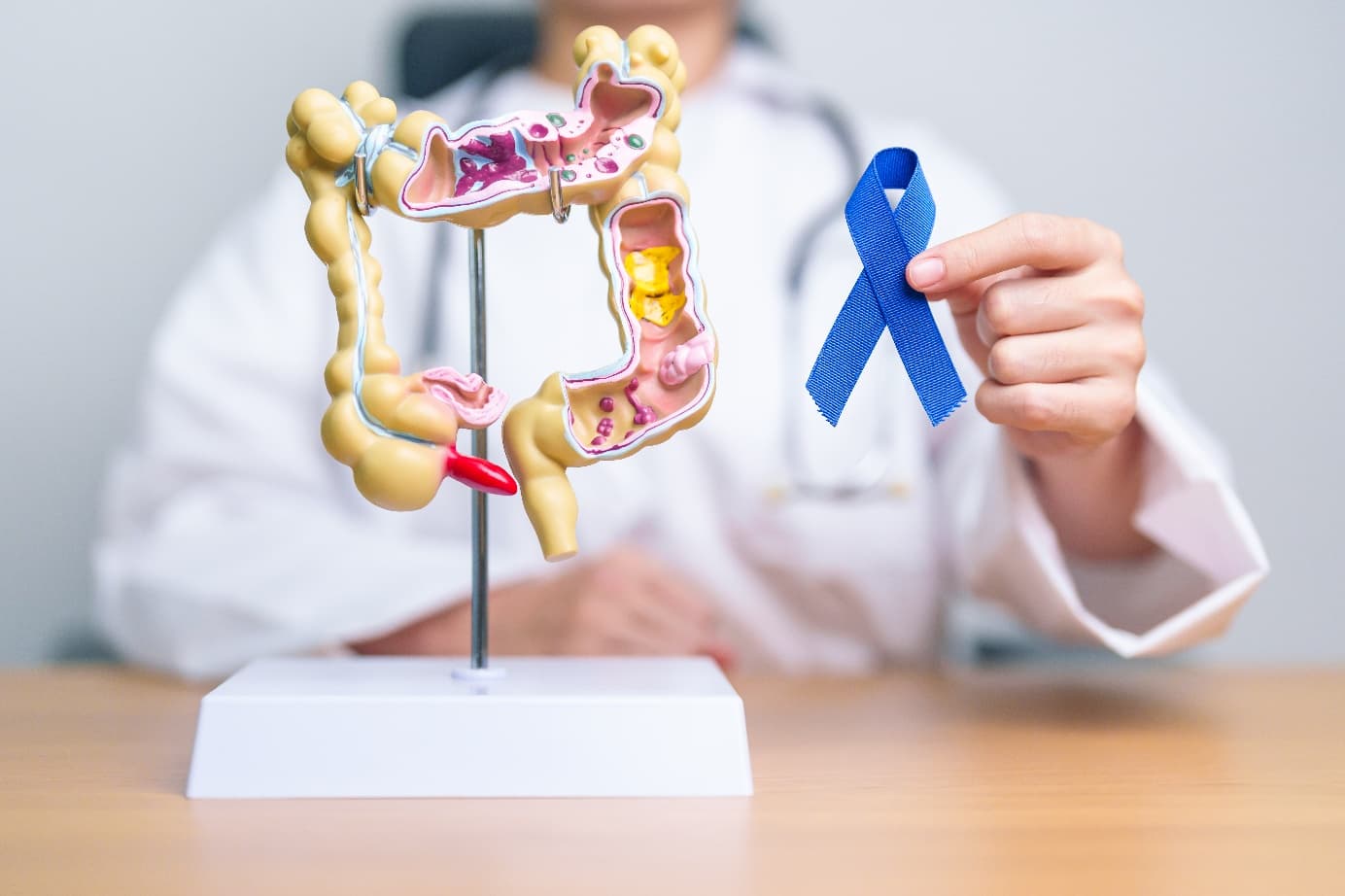 Cancer colorectal avant 50 ans : The Lancet annonce une série spéciale pour appeler à l'action