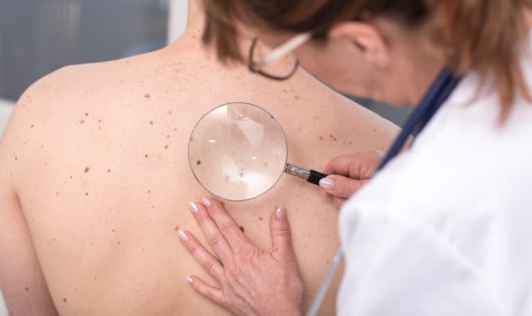 Neoadjuvant Immunotherapy in Melanoma: Five-Year Survival Data