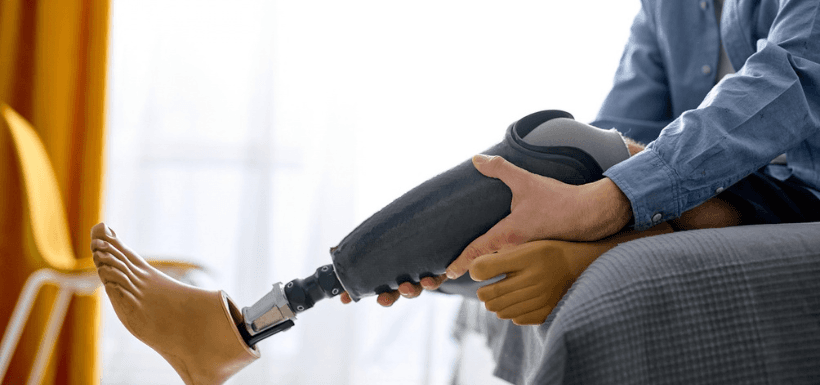 Polylaminine et retour de la contraction motrice volontaire après une lésion médullaire complète : une étude pilote marquante