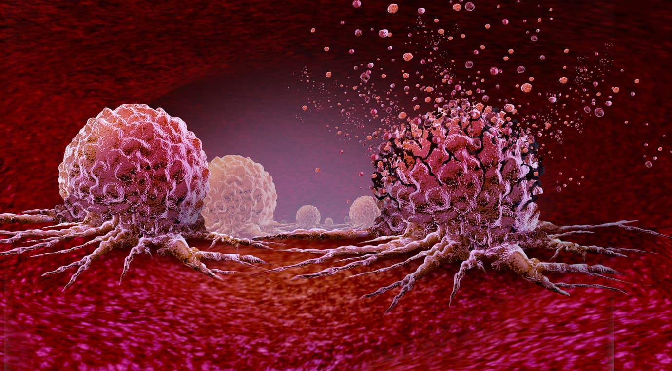 Reprogramming fat to starve the tumor?