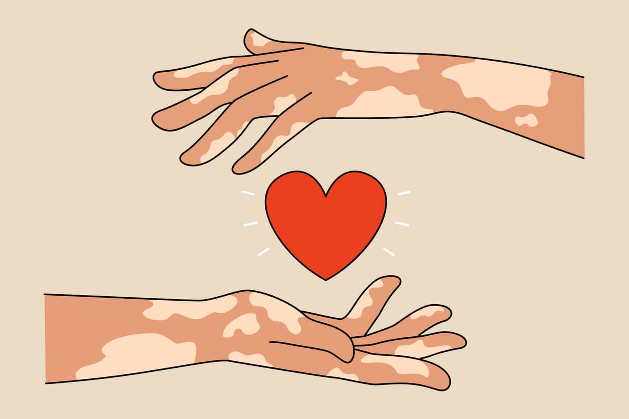Leprosy Vaccines: An Opportunity to Eradicate a Millennia-Old Disease
