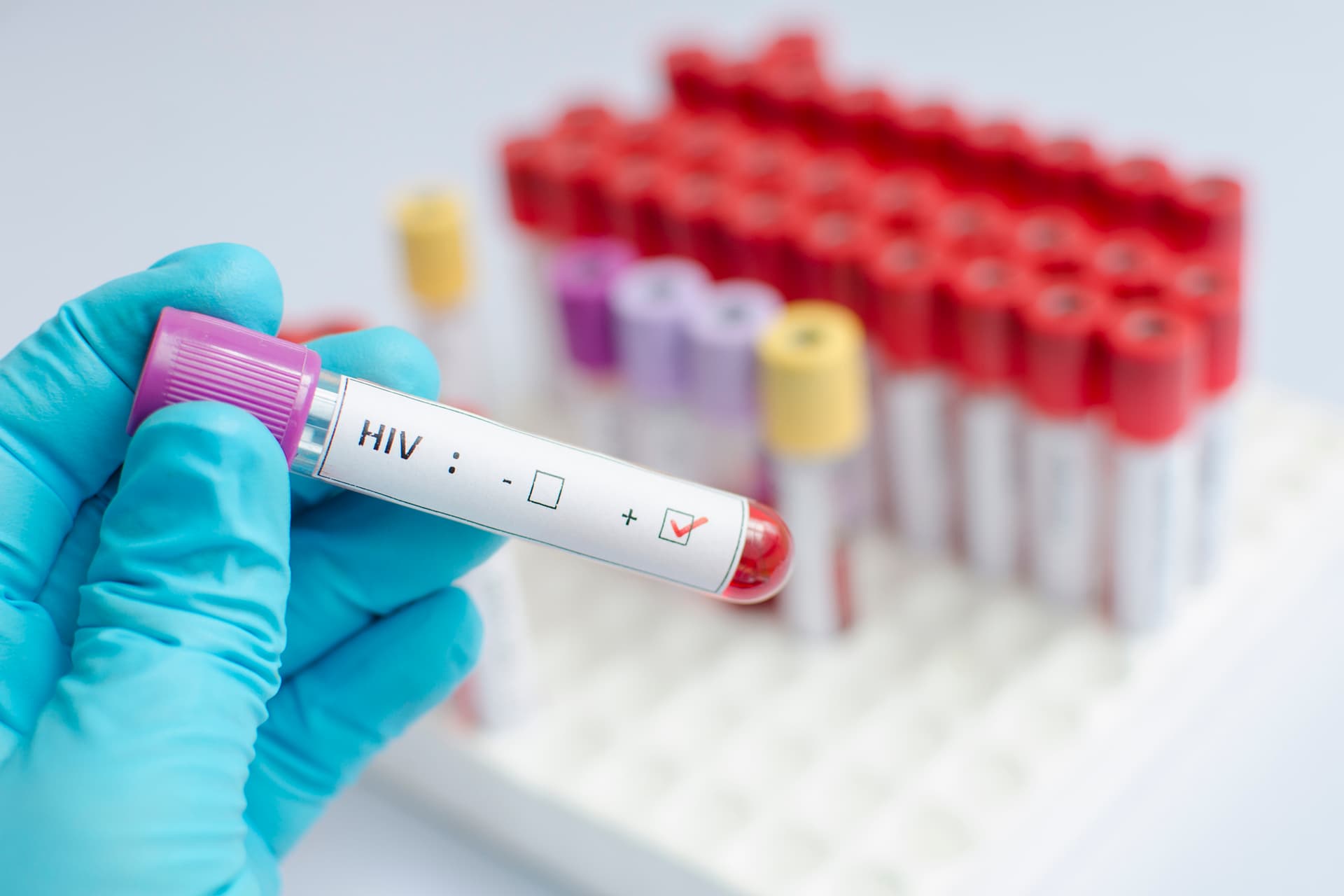 HIV and Dual Therapy: a promising step towards maintaining viral suppression