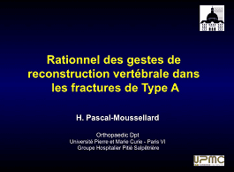 Hugues PASCAL-MOUSSELARD · Rationnel des gestes de reconstruction vertébrale dans les fractures de Type A