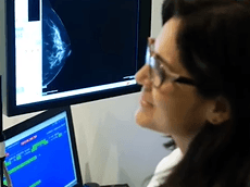 SenoBright HD Testimonial Video - Hospital del Mar