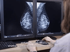 Senographe Crystal Nova Digital Mammography: Radiologists Testimonial