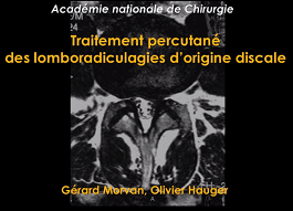 Henri GUERINI, Olivier HAUGER, Gerard MORVAN, Valérie VUILLEMIN · Traitement percutané des lomboradiculalgies d'origine discale
