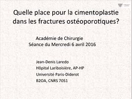 Jean Denis LAREDO, Philippe ORCEL · Vertébroplastie, cyphoplastie et cimentoplastie dans les fractures ostéoporotiques