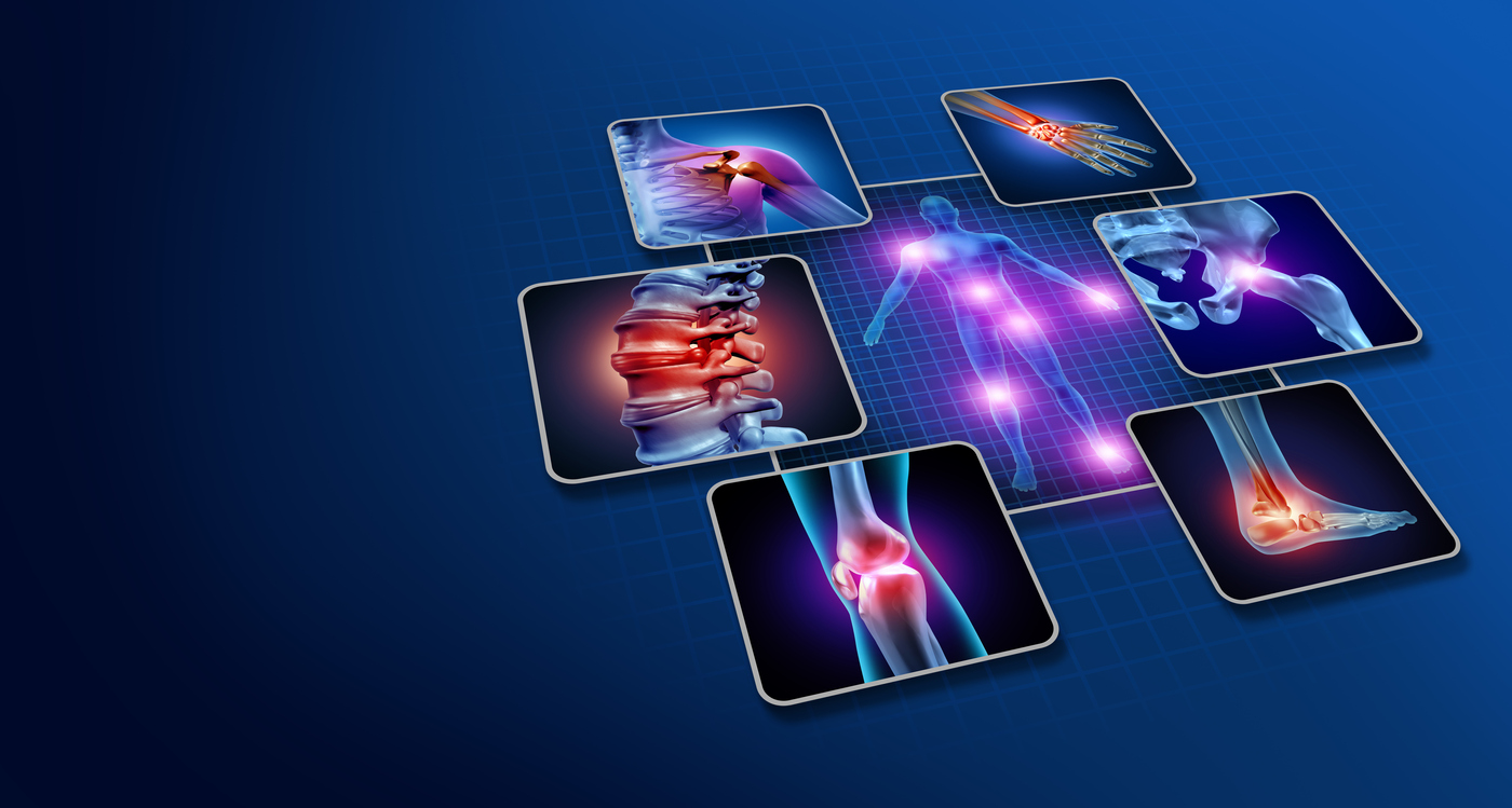 2 nouvelles indications pour Ixékizumab en Rhumatologie 2 nouvelles indications pour Ixékizumab en Rhumatologie