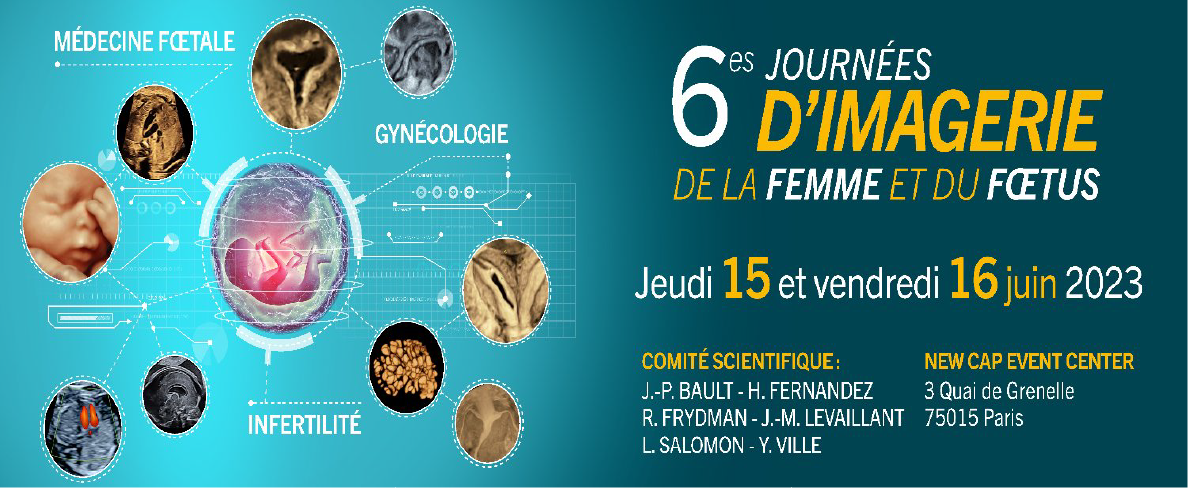 6es Journées d'imagerie de la femme & du fœtus - JIFF 2023