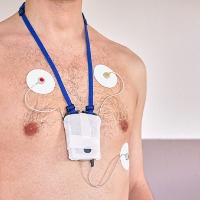A Toulouse, les troubles du rythme cardiaque détectés par une intelligence artificielle. A Toulouse, les troubles du rythme cardiaque détectés par une intelligence artificielle.