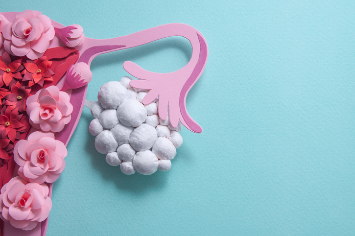 GLP-1 Analogues and Polycystic Ovary Syndrome: A New Approach Beyond Weight Loss?