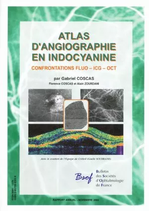 Atlas d'Angiographie et Indocyanine - Confrontations Fluo - ICG - OCT Atlas d'Angiographie et Indocyanine - Confrontations Fluo - ICG - OCT