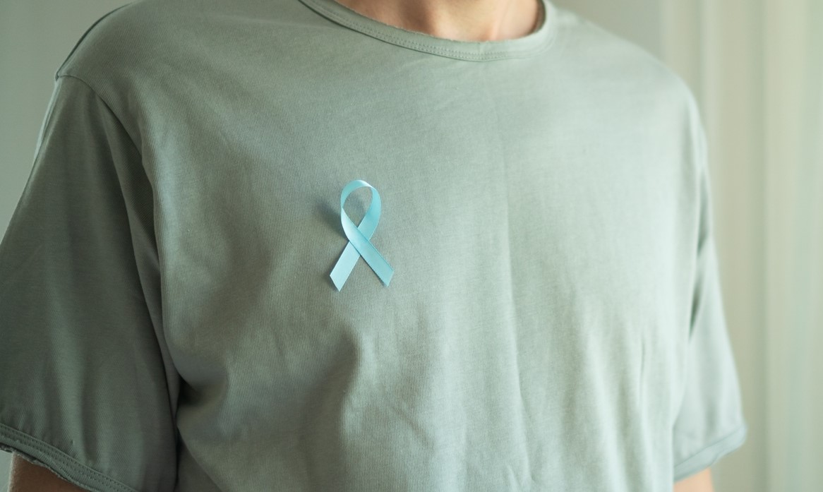CAR-T et cancer colorectal : le défi des tumeurs solides