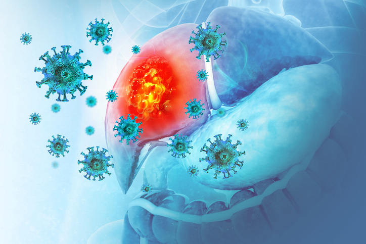 Carcinome hépatocellulaire en Europe : un paysage épidémiologique en pleine évolution