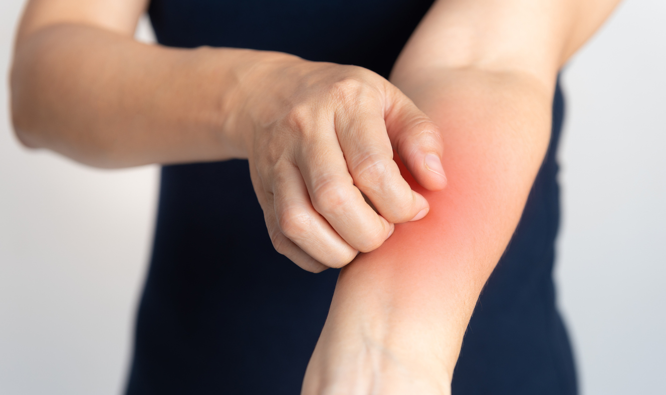 Cellules immunes et lupus systémique : une dérégulation globale du système immunitaire