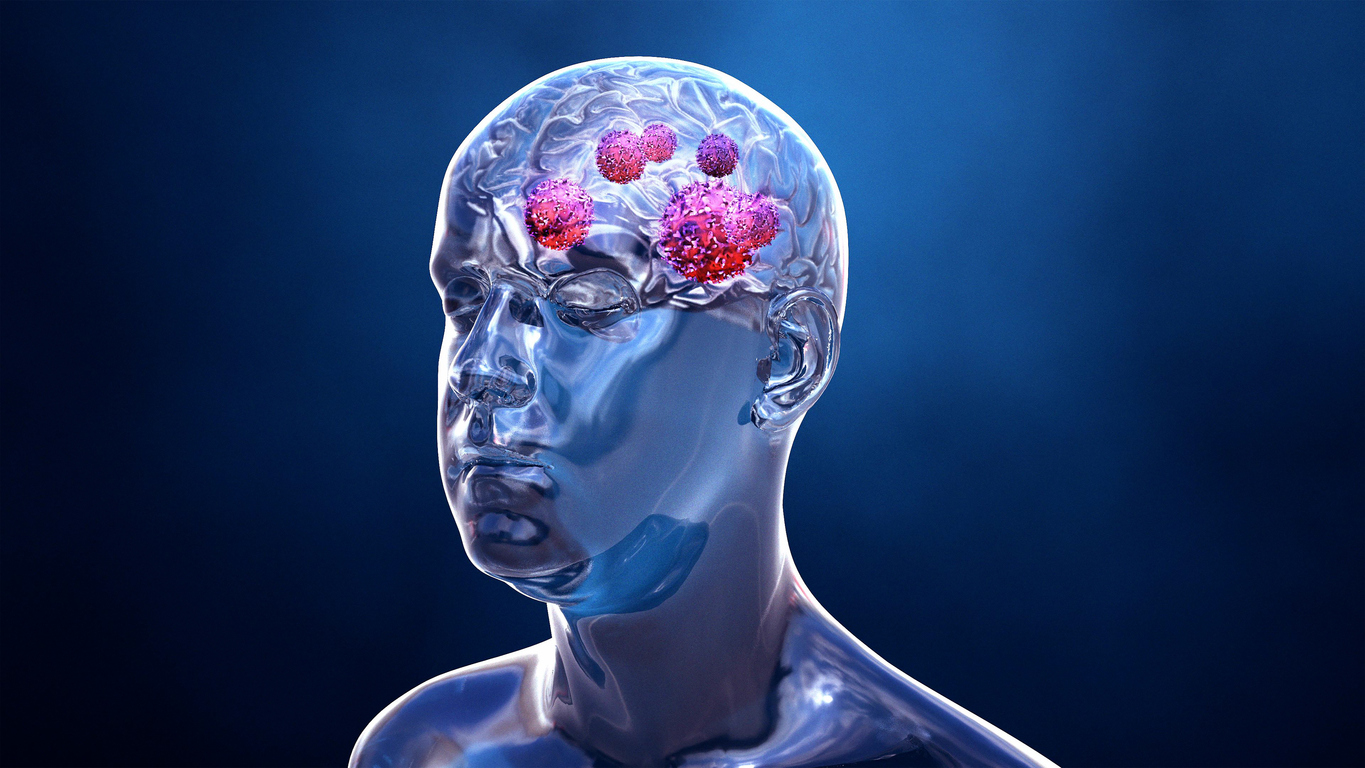 Cerveau sous pression : l’ultime frontière ? Cerveau sous pression : l’ultime frontière ?