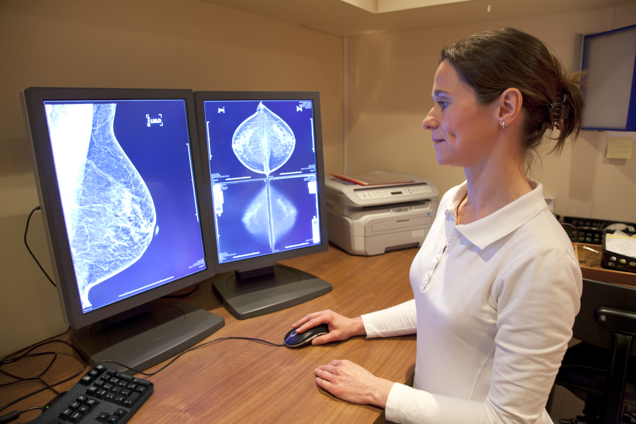 How can we combat chemoresistance in triple-negative breast cancer ? How can we combat chemoresistance in triple-negative breast cancer ?