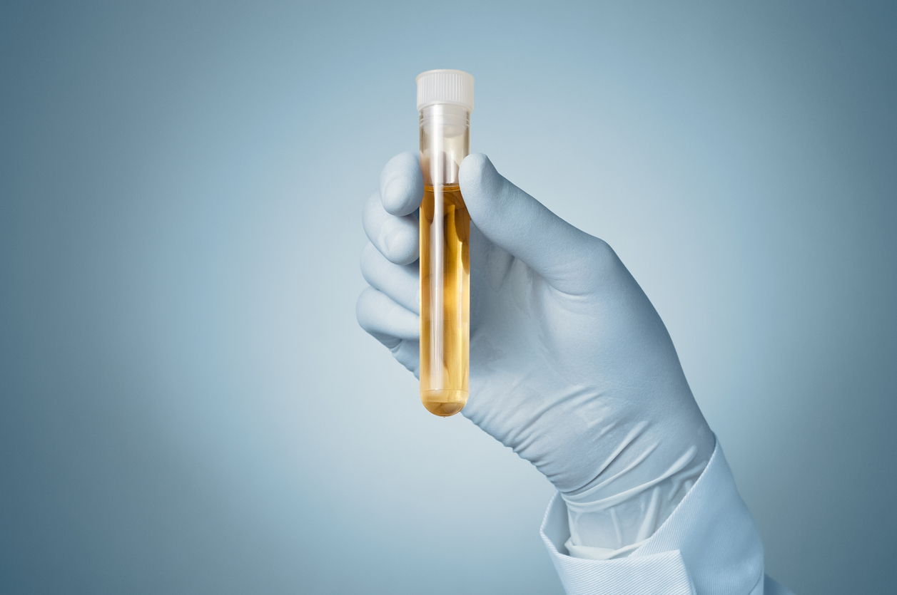 Diagnostic d’une infection urinaire chez le jeune enfant Diagnostic d’une infection urinaire chez le jeune enfant