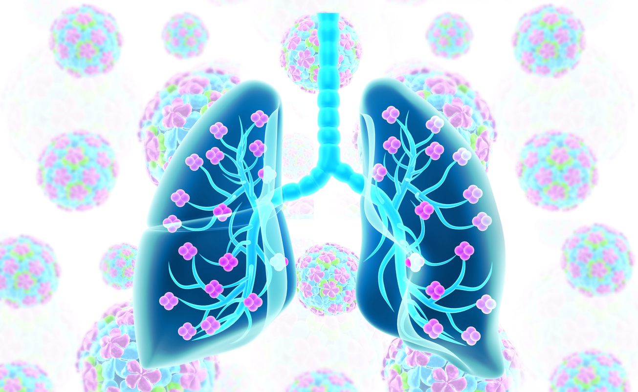 Double greffe du poumon pour un malade du Covid-19, une première en France