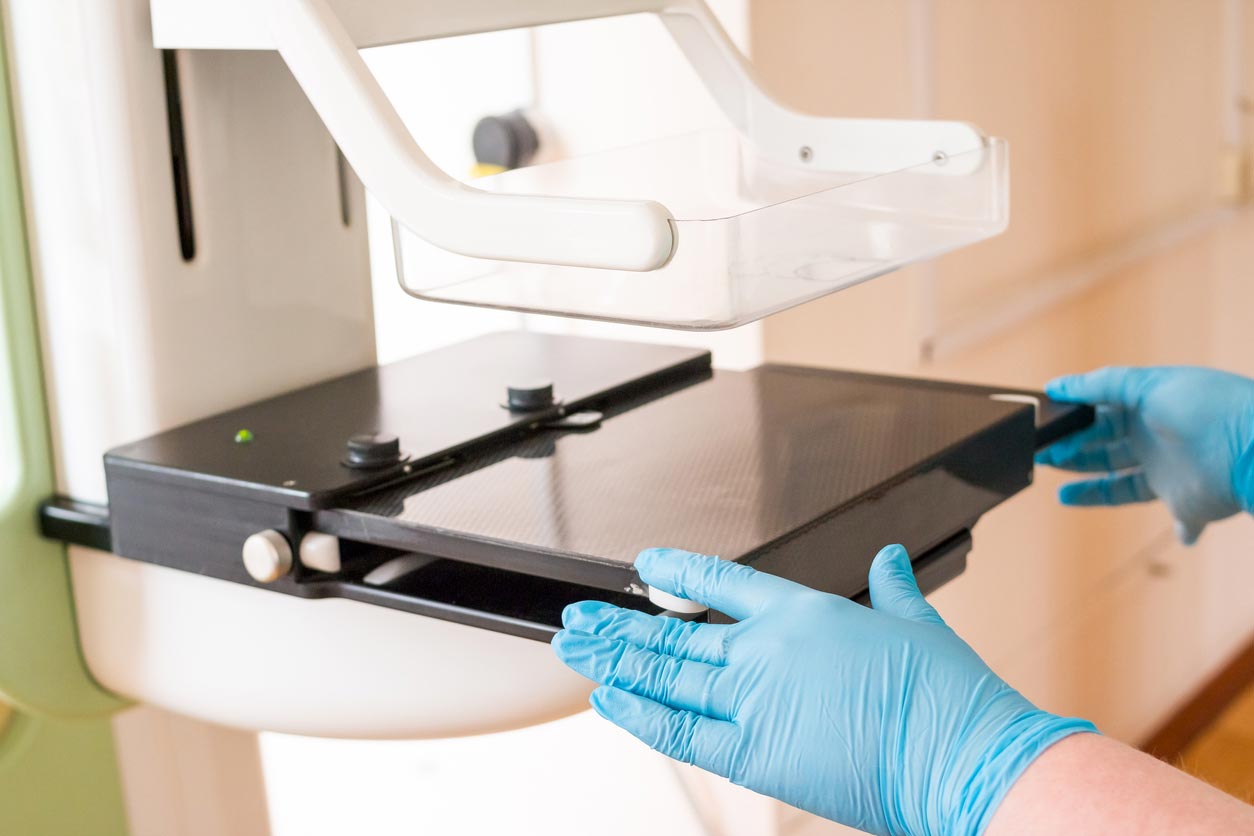 Effet bénéfique de la mammographie à partir de 40 ans Effet bénéfique de la mammographie à partir de 40 ans
