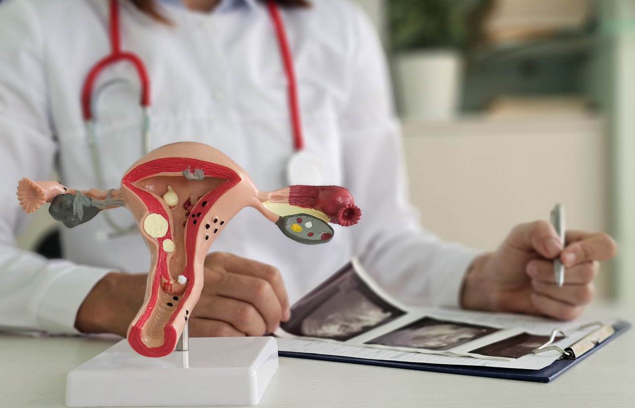 Endomètre : l’espoir renaît avec le PARP ?