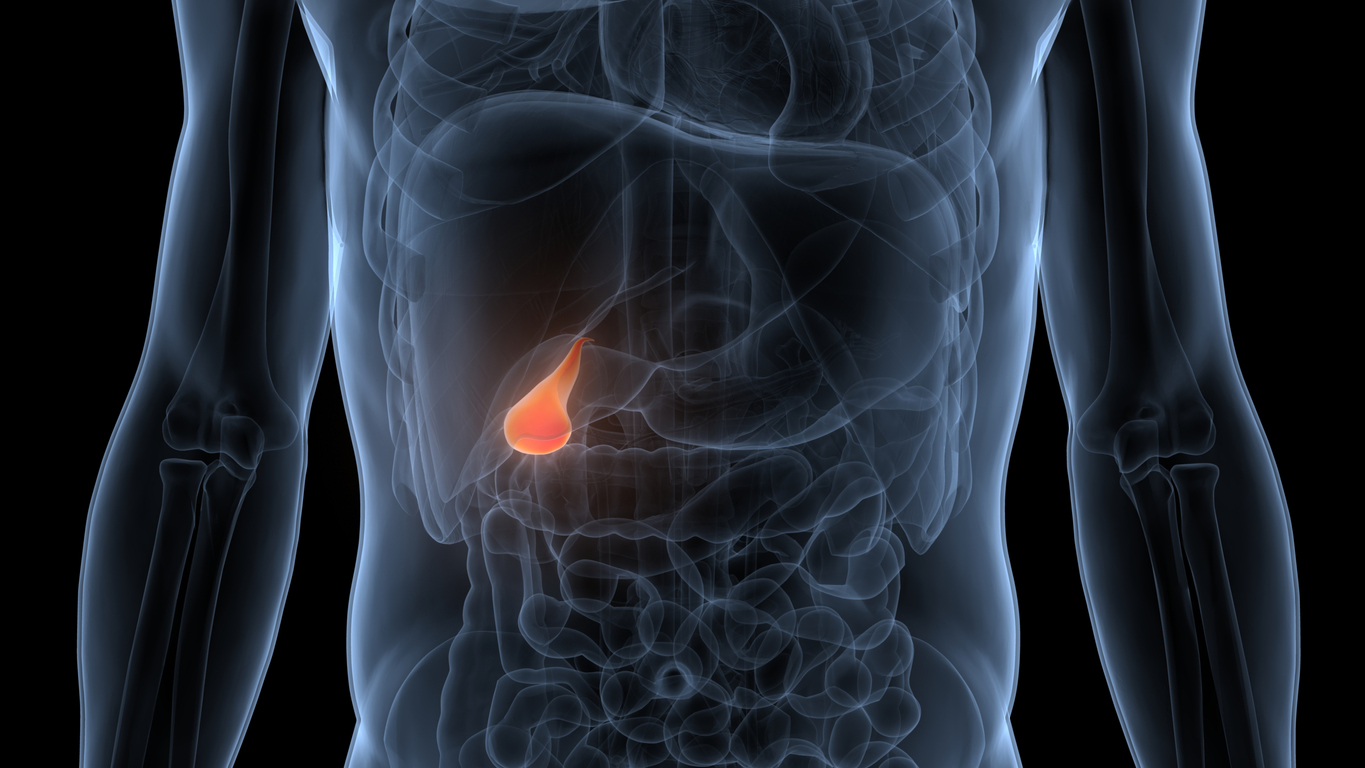 Evaluation du tucatinib et du trastuzumab dans le cancer métastatique des voies biliaires HER2+ Evaluation du tucatinib et du trastuzumab dans le cancer métastatique des voies biliaires HER2+