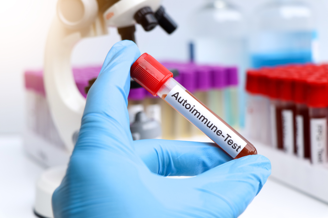 Evolution des maladies inflammatoires à médiation immunitaire entre 1990 et 2019 Evolution des maladies inflammatoires à médiation immunitaire entre 1990 et 2019