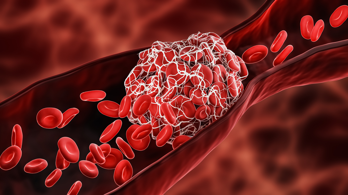 Factor VIII and Von Willebrand factor Factor VIII and Von Willebrand factor