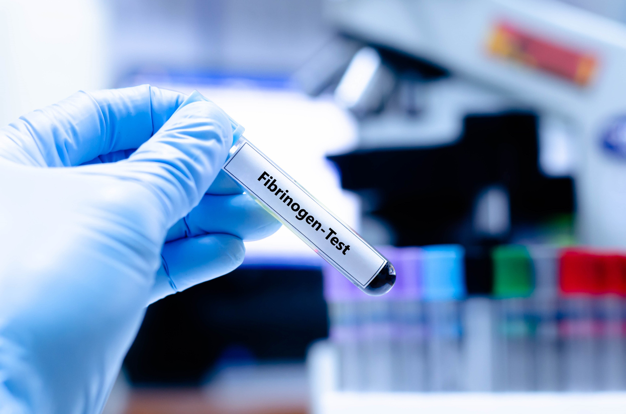 Early fibrinogen: a lifesaving drip? Early fibrinogen: a lifesaving drip?