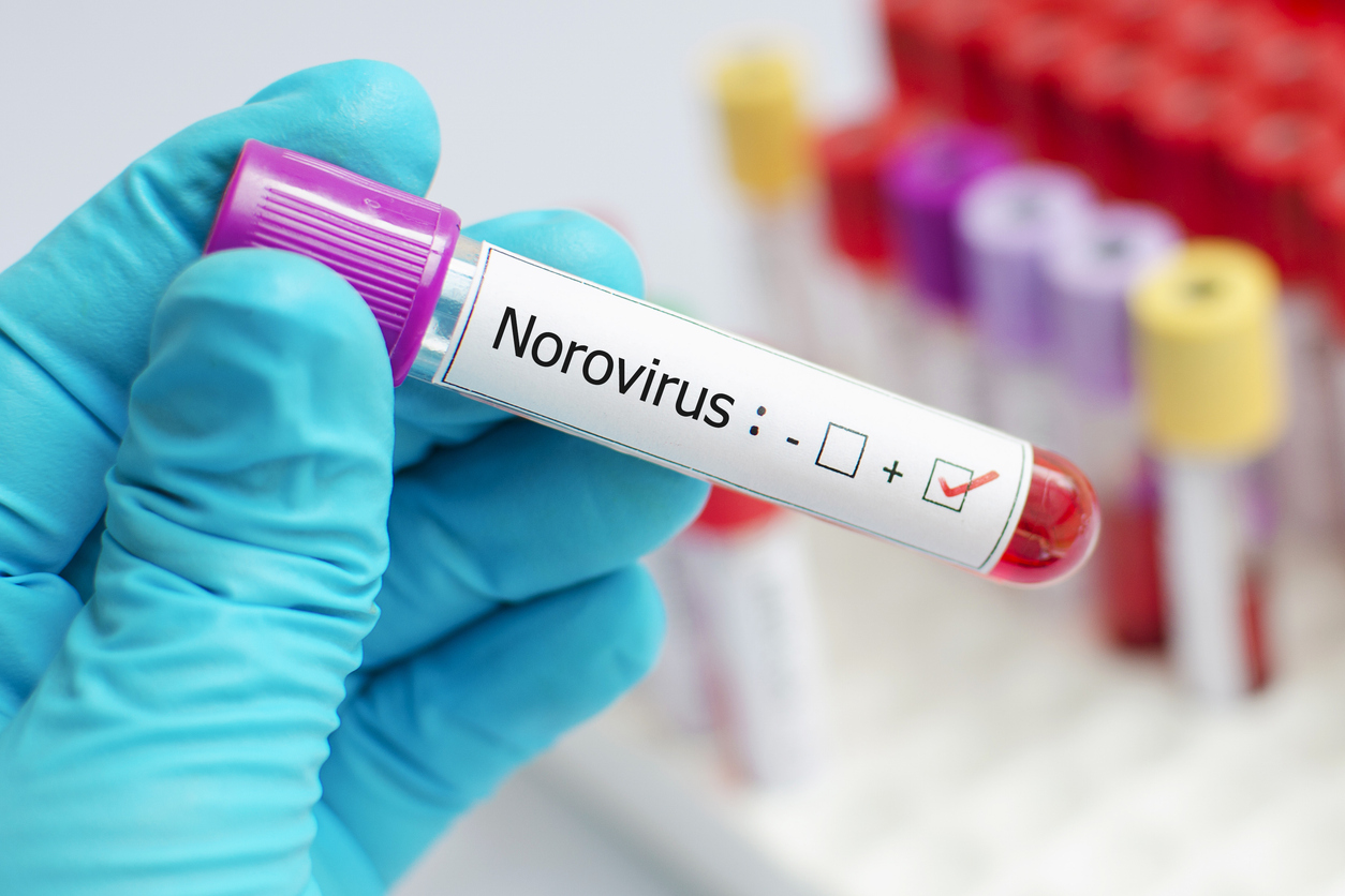 Norovirus Gastroenteritis: A Turning Point with the GII.4 Sydney Variant Norovirus Gastroenteritis: A Turning Point with the GII.4 Sydney Variant