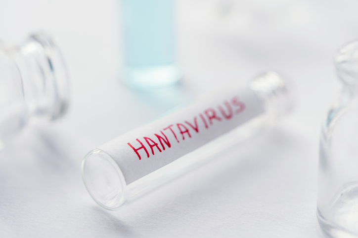 Hantavirus : comment le virus détourne la cellule ?