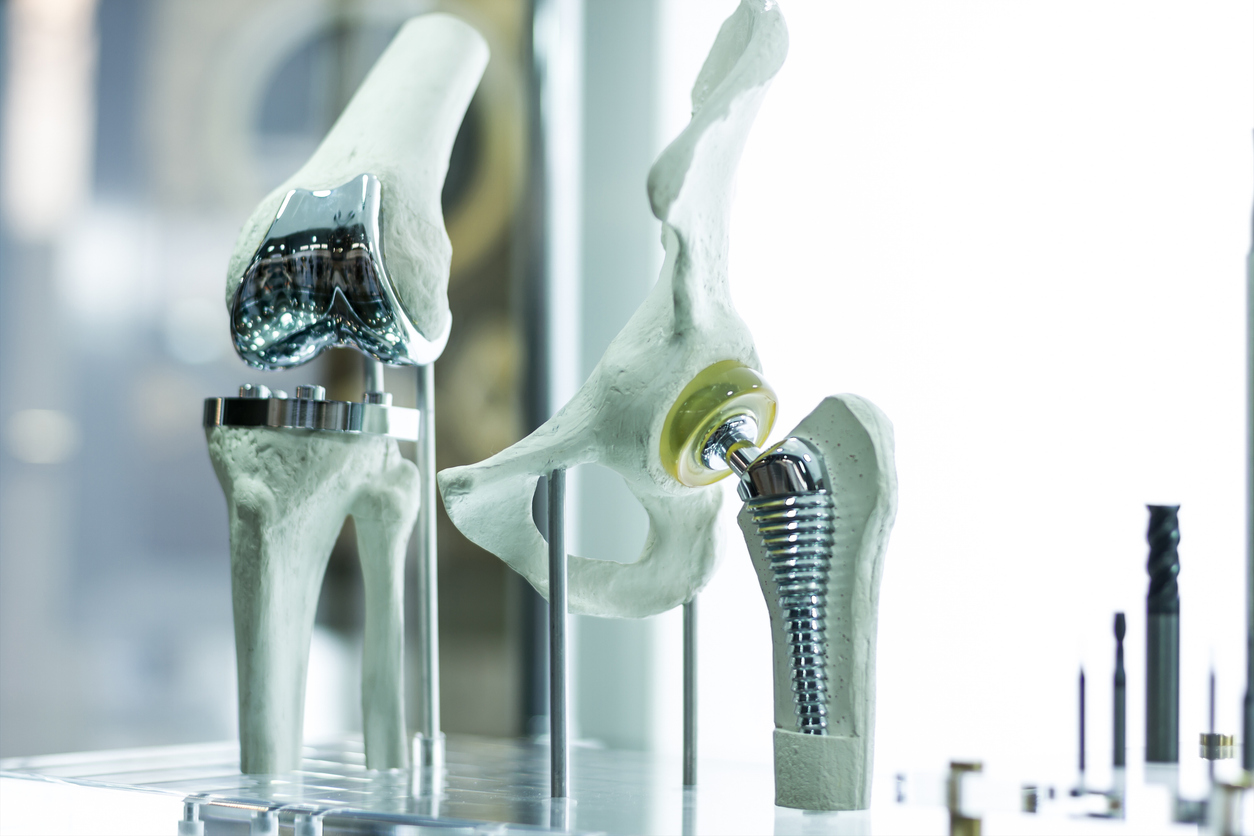 Impact of lower limb prostheses on quality of life Impact of lower limb prostheses on quality of life