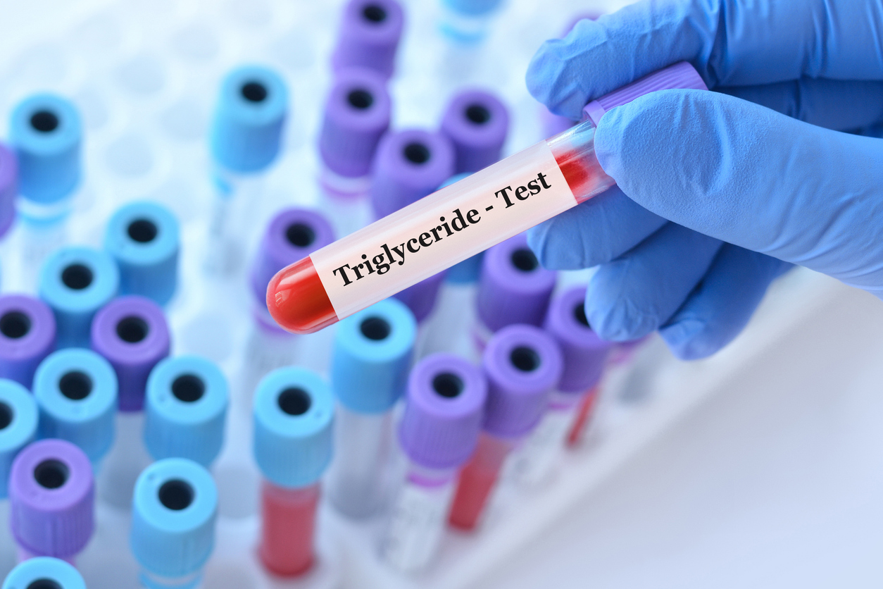 Index triglycérides-glucose et douleur thoracique Index triglycérides-glucose et douleur thoracique