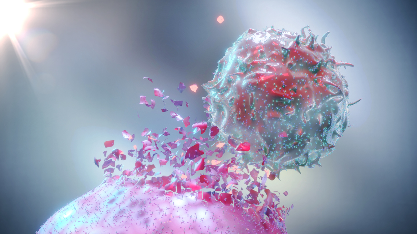 L’épuisement lymphocytaire dans le carcinome épidermoïde de la tête et du cou L’épuisement lymphocytaire dans le carcinome épidermoïde de la tête et du cou