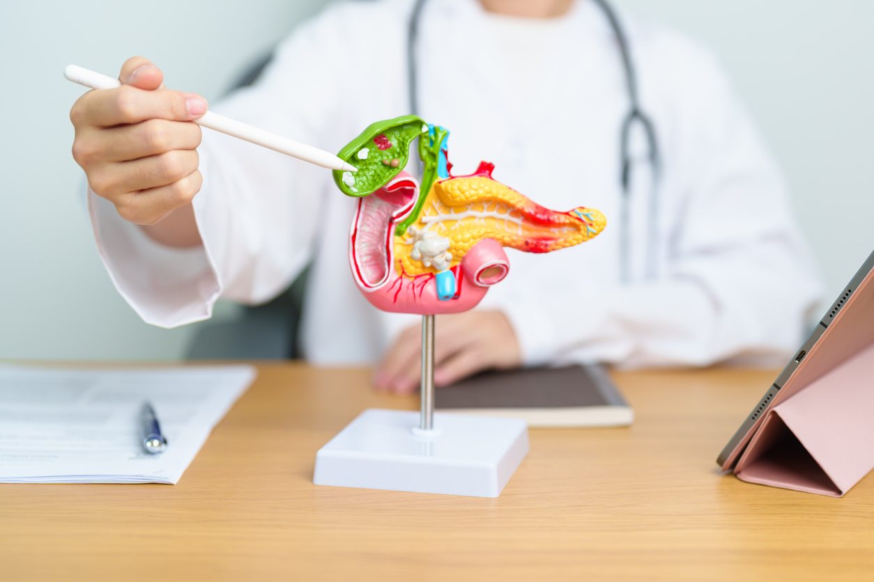 La cholécystectomie chez les patients atteints de pancréatite biliaire aiguë La cholécystectomie chez les patients atteints de pancréatite biliaire aiguë