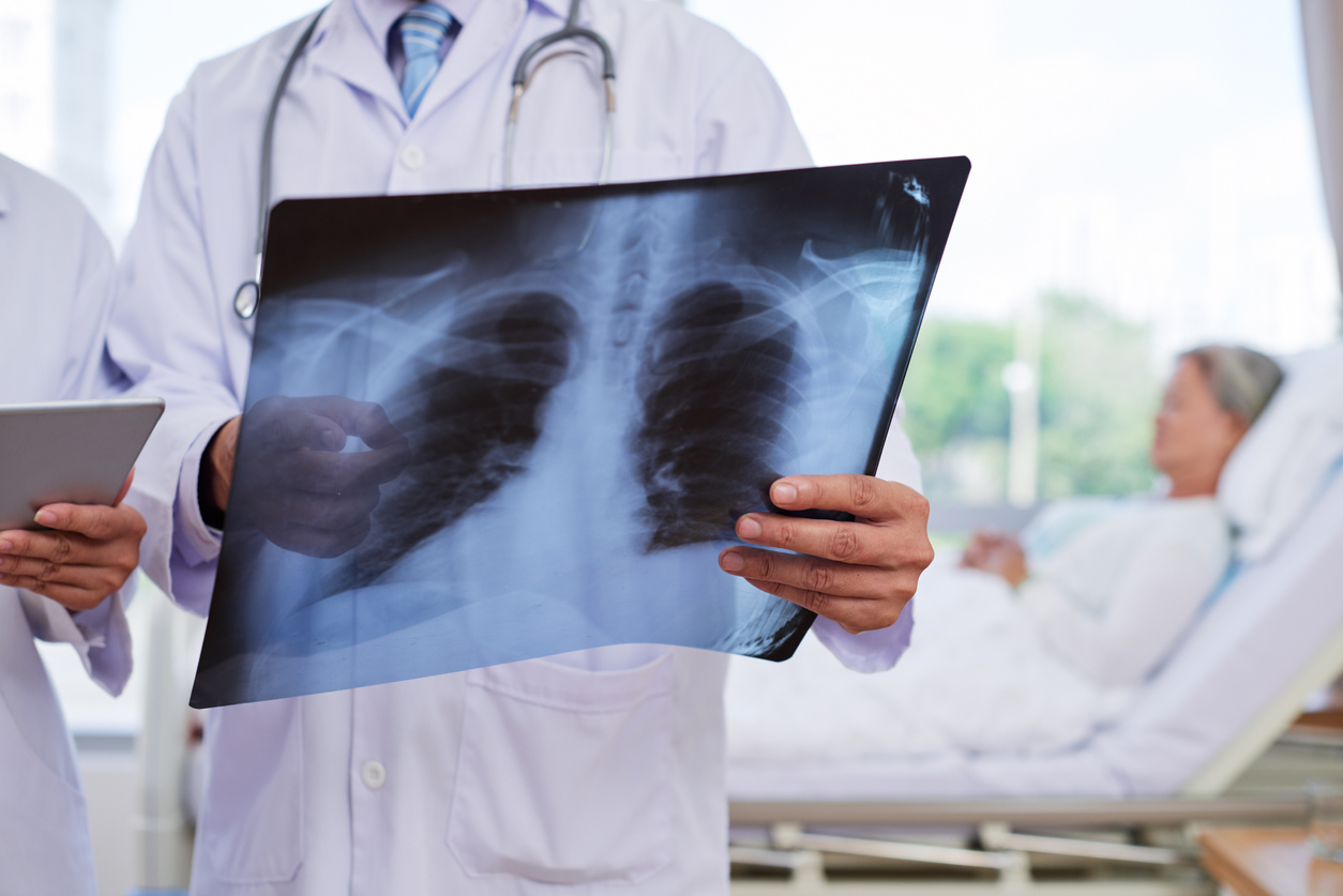 Le diagnostic de la pneumonie à Pneumocystis jirovecii Le diagnostic de la pneumonie à Pneumocystis jirovecii