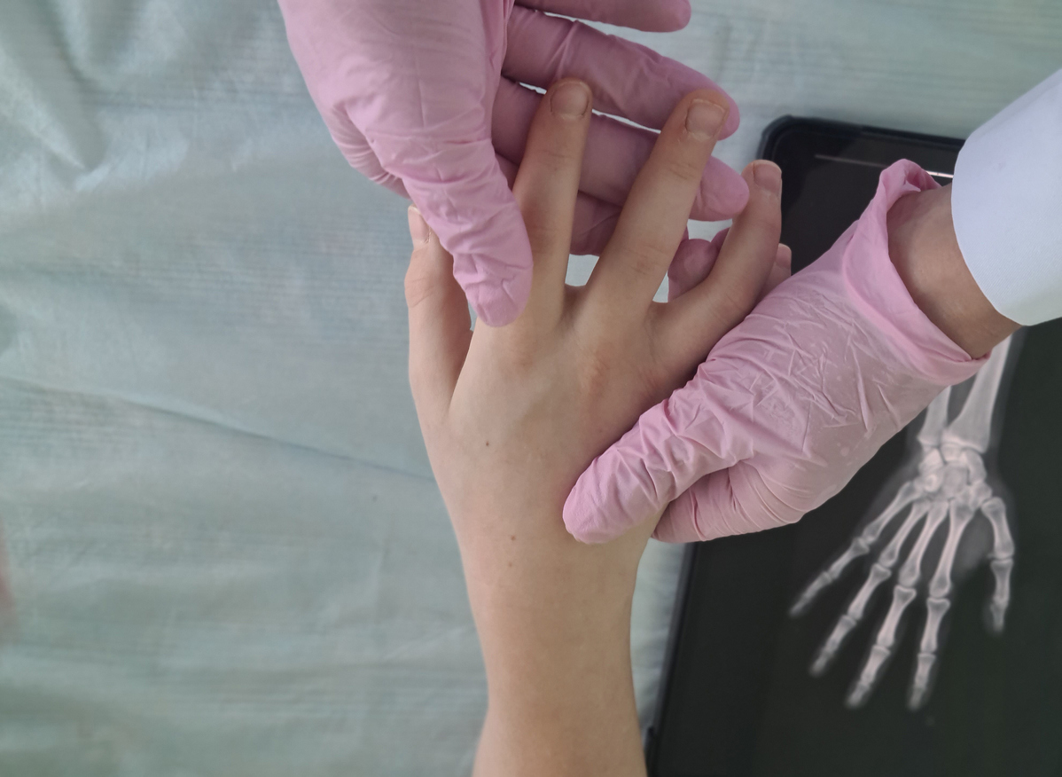 Le méthotrexate dans l’arthrite juvénile idiopathique Le méthotrexate dans l’arthrite juvénile idiopathique