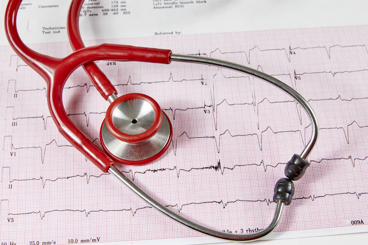 Les anticoagulants oraux non AVK dans la fibrillation auriculaire, en fonction du poids corporel Les anticoagulants oraux non AVK dans la fibrillation auriculaire, en fonction du poids corporel