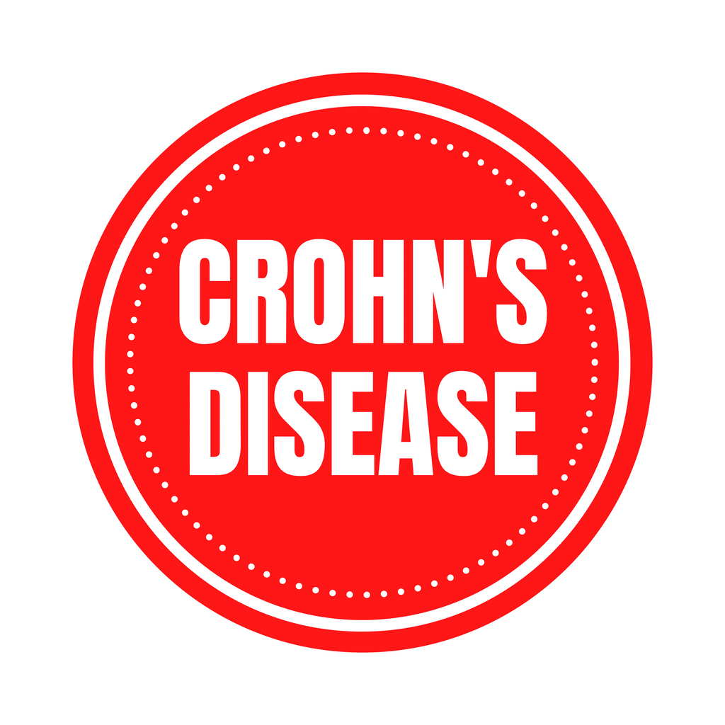 Les antigènes alimentaires dans la maladie de Crohn Les antigènes alimentaires dans la maladie de Crohn