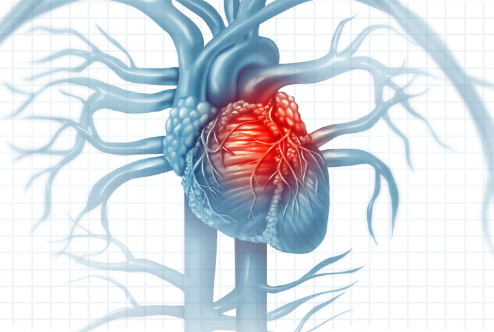 Les thérapies combinées à doses fixes dans la prévention primaire et secondaire des maladies cardiovasculaires.