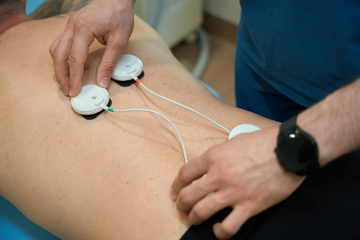 Neuromodulation de la douleur neuropathique : quelles techniques offrent le meilleur soulagement ?