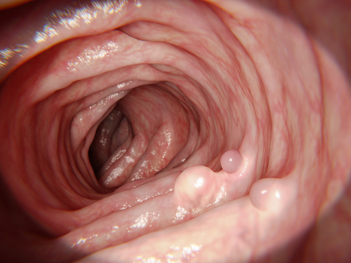 New data on the three-dimensional anatomy of the enteric nervous system New data on the three-dimensional anatomy of the enteric nervous system