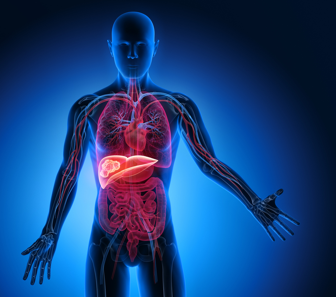 Clinical decision-making in advanced hepatocellular carcinoma Clinical decision-making in advanced hepatocellular carcinoma