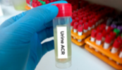 Uremic toxins and cardiovascular mortality in diabetic chronic kidney disease Uremic toxins and cardiovascular mortality in diabetic chronic kidney disease