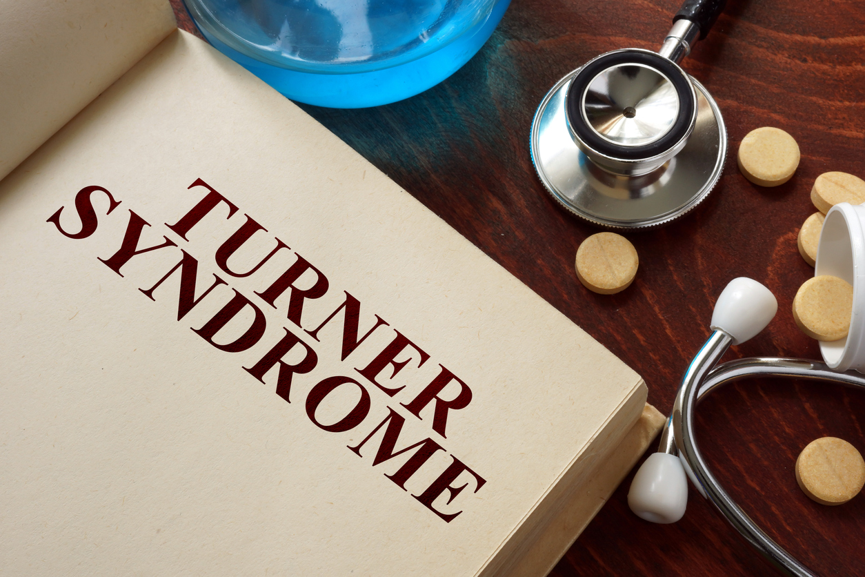 Turner syndrome and autoimmunity: an underestimated association?